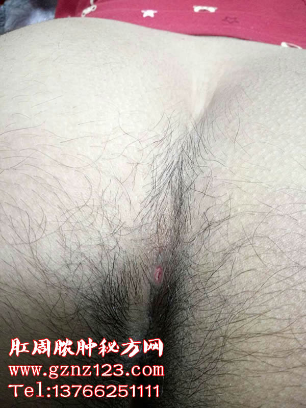 ŧ